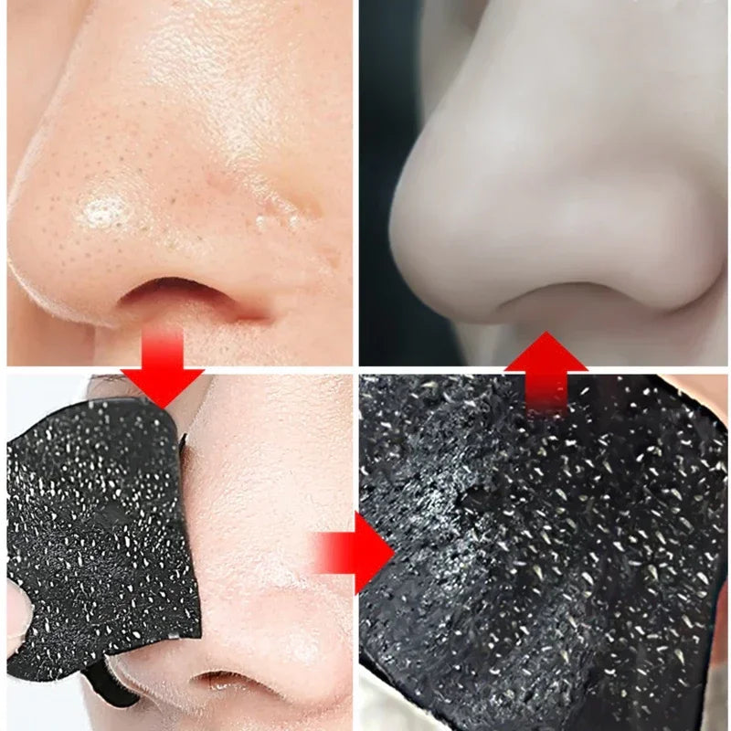 Nose Strips For Blackheads Acne Removal