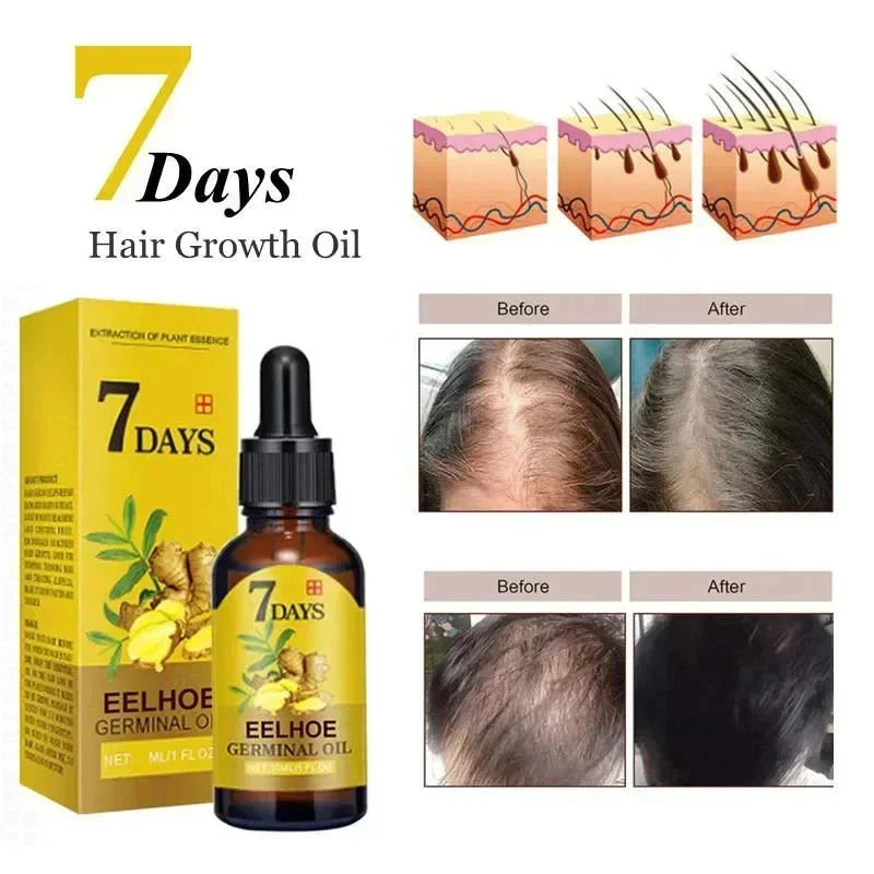 Ginger Hair Growth Serum Anti Hair Loss