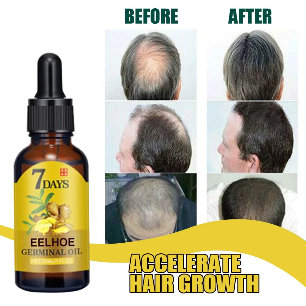 Ginger Hair Growth Serum Anti Hair Loss