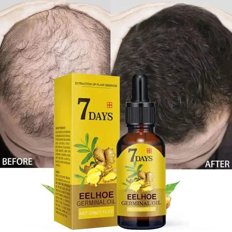 Ginger Hair Growth Serum Anti Hair Loss